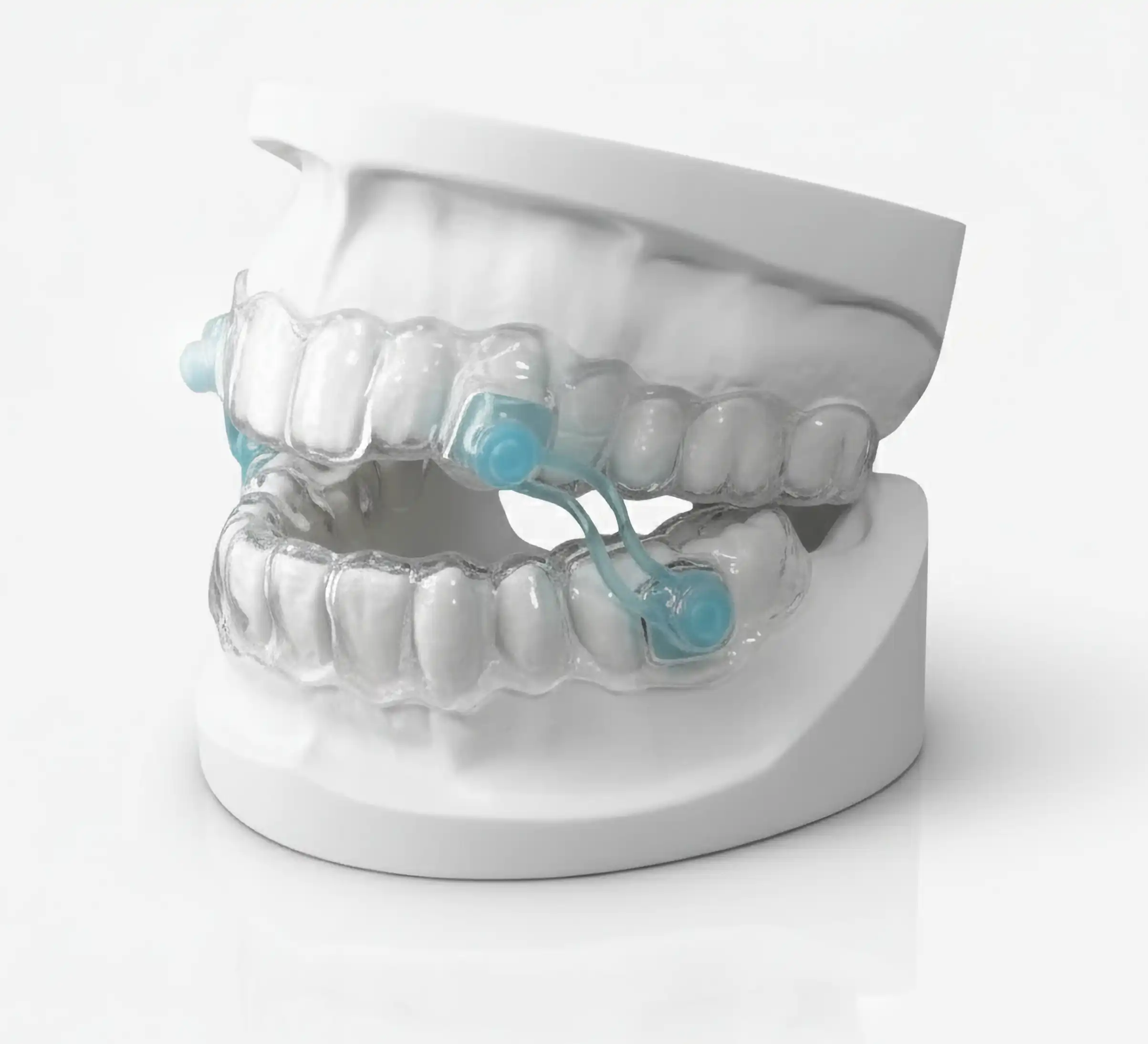 Schiene erhalten - Schritt 03